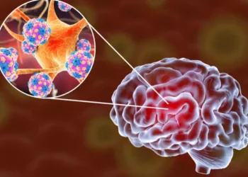 Προσοχή: Η ύπουλη εγκεφαλική ασθένεια που μοιάζει με γρίπη – Συμπτώματα