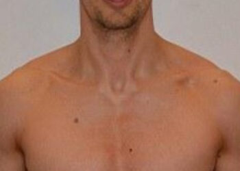 Έχασε το 75% του σωματικού του λίπους σε 3 μήνες με ελάχιστη άσκηση [photos]