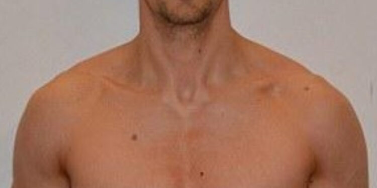 Έχασε το 75% του σωματικού του λίπους σε 3 μήνες με ελάχιστη άσκηση [photos]