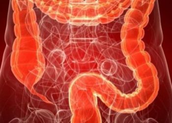 Πως να μειώσετε κατά 20%-40% την πιθανότητα εμφάνισης καρκίνου του εντέρου