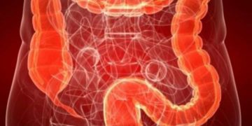 Alldaynews.gr Πως να μειώσετε κατά 20%-40% την πιθανότητα εμφάνισης καρκίνου του εντέρου