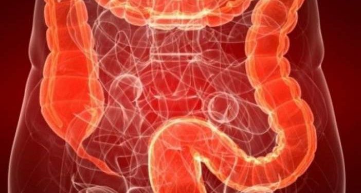 Alldaynews.gr Πως να μειώσετε κατά 20%-40% την πιθανότητα εμφάνισης καρκίνου του εντέρου