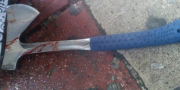 Alldaynews.gr Του έκοψε το πέος με τσεκούρι επειδή ήταν μεγαλύτερο από το δικό του!