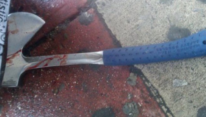 Alldaynews.gr Του έκοψε το πέος με τσεκούρι επειδή ήταν μεγαλύτερο από το δικό του!