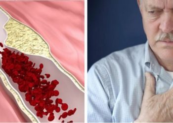 4 ΣΙΩΠΗΛΑ σημάδια πως μπορεί να έχετε ΦΡΑΓΜΕΝΕΣ αρτηρίες