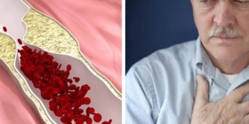 Alldaynews.gr 4 ΣΙΩΠΗΛΑ σημάδια πως μπορεί να έχετε ΦΡΑΓΜΕΝΕΣ αρτηρίες