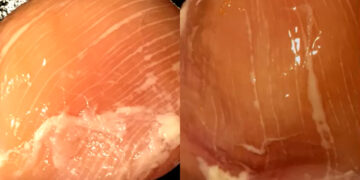 Μην αγοράζετε φιλέτα κοτόπουλου που έχουν αυτή την εμφάνιση