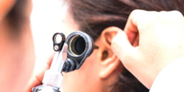 Τα 7 πιο απίθανα πράγματα που έχουν βρει οι γιατροί μέσα σε… αυτιά ασθενών