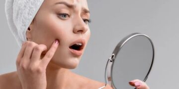 Πώς να εξαφανίσετε ένα σπυράκι με πύον σε 5 απλά βήματα – Κόλπα για να διώξεις τα σπυράκια σου (εικόνες)