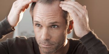 Τριχόπτωση – Φαλάκρα: Τι επιλογές υπάρχουν για φυσική αναγέννηση μαλλιών