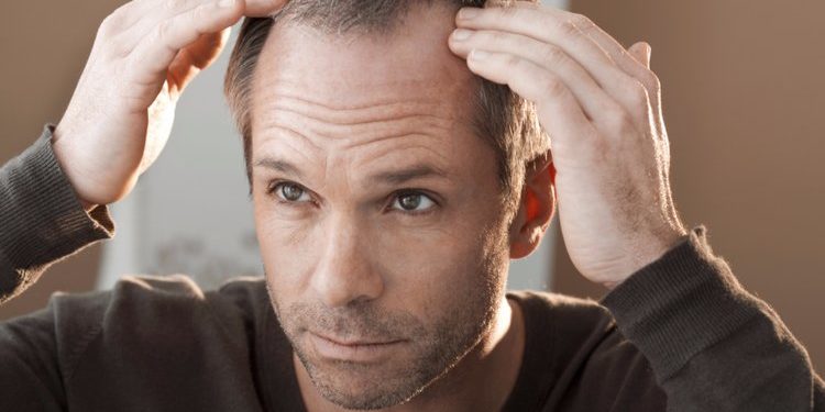 Τριχόπτωση – Φαλάκρα: Τι επιλογές υπάρχουν για φυσική αναγέννηση μαλλιών