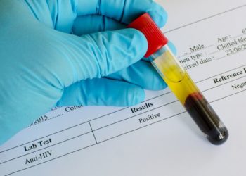 ΕΟΦ: Κλείνει ιστοσελίδα που υποσχόταν φυτική θεραπεία για το AIDS