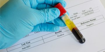 ΕΟΦ: Κλείνει ιστοσελίδα που υποσχόταν φυτική θεραπεία για το AIDS