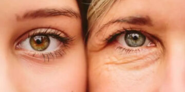 Alldaynews.gr Έξι καθημερινές συνήθειες που “γερνάνε” τα μάτια σας