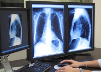 Διέγνωσε “φυσιολογική σπλήνα”, ενώ ο ασθενής την είχε αφαιρέσει!