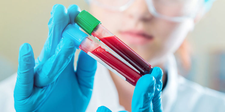 Λευχαιμία: Οι εύκολες μελανιές και τα «ύπουλα» σημάδια στο δέρμα (εικόνες)