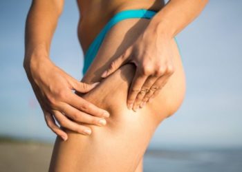 Φτιάξε μόνη σου Λάδι για να πεις αντίο στην κυτταρίτιδα