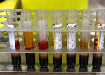 Κρήτη: Άντρας πήγε για εξέταση αίματος και βγήκε… έγκυος