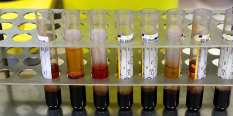 Κρήτη: Άντρας πήγε για εξέταση αίματος και βγήκε… έγκυος