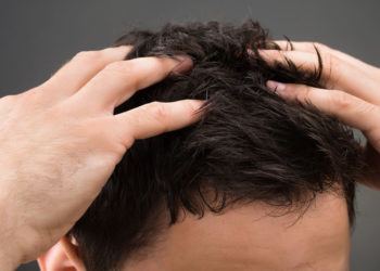 Κι όμως, το «φάρμακο» για την πιτυρίδα βρίσκεται στο σπίτι σας