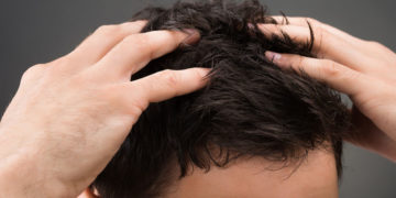 Alldaynews.gr Κι όμως, το «φάρμακο» για την πιτυρίδα βρίσκεται στο σπίτι σας