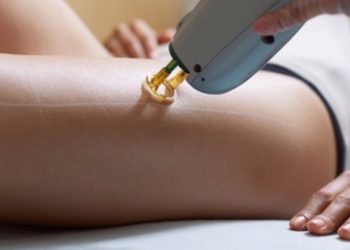 Αποτρίχωση με λέιζερ: Οι παρενέργειες στο δέρμα – Δείτε πώς γίνεται (Videos)