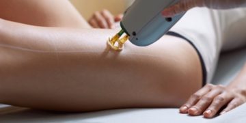 Alldaynews.gr Αποτρίχωση με λέιζερ: Οι παρενέργειες στο δέρμα – Δείτε πώς γίνεται (Videos)