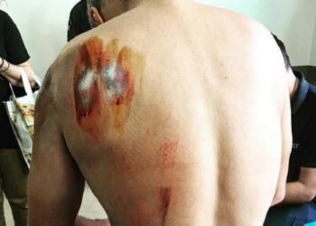 Σκύλος επιτέθηκε σε αστυνομικό στο Αγρίνιο – Νοσηλεύεται με σοβαρά τραύματα