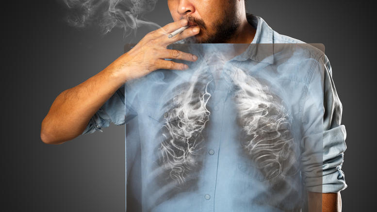 Καρκίνος του πνεύμονα: Γιατί δεν «αγγίζει» ορισμένους μανιώδεις καπνιστές