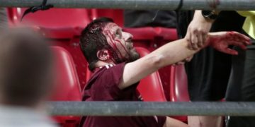 Alldaynews.gr Τέσσερις τραυματίες Γερμανοί – ανοιγμένα κεφάλια στου Ρέντη! (pics)