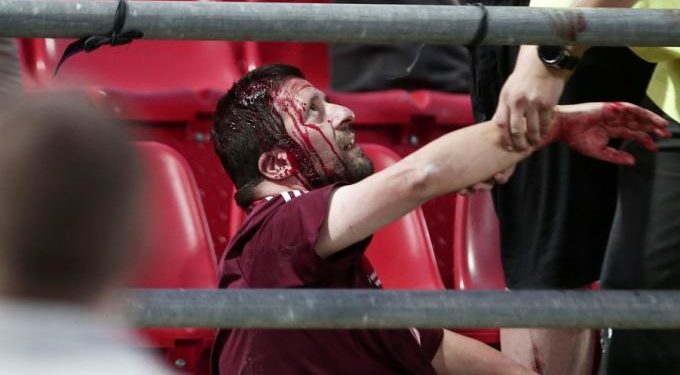 Alldaynews.gr Τέσσερις τραυματίες Γερμανοί – ανοιγμένα κεφάλια στου Ρέντη! (pics)