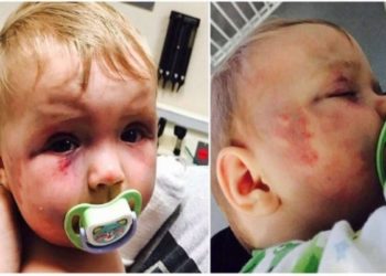 Θυμάστε το μωράκι που δέχθηκε επίθεση από την ίδια του τη μάνα; Δείτε πως είναι σήμερα και θα δακρύσετε!