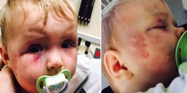 Alldaynews.gr Θυμάστε το μωράκι που δέχθηκε επίθεση από την ίδια του τη μάνα; Δείτε πως είναι σήμερα και θα δακρύσετε!