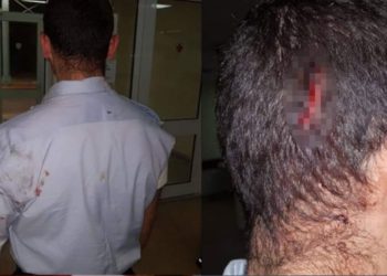 Αστυνομικοί πήγαν για διατάραξη κοινής ησυχίας και έφαγαν ξύλο!