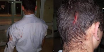 Alldaynews.gr Αστυνομικοί πήγαν για διατάραξη κοινής ησυχίας και έφαγαν ξύλο!