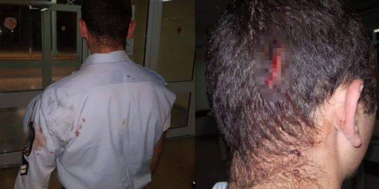 Alldaynews.gr Αστυνομικοί πήγαν για διατάραξη κοινής ησυχίας και έφαγαν ξύλο!