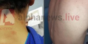 Alldaynews.gr Ξυλοκοπούσαν άγρια μαθητή με νοητική υστέρηση – «Θα σε σκοτώσουμε όταν έρθεις στο σχολείο» (pics)