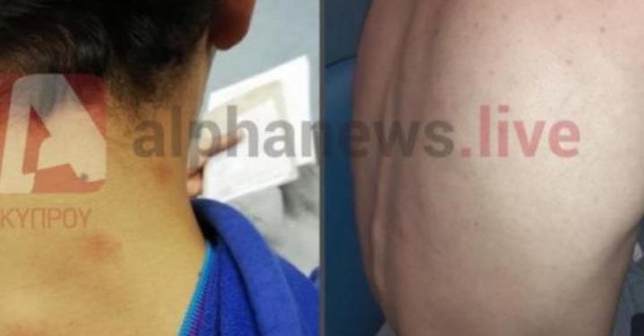 Alldaynews.gr Ξυλοκοπούσαν άγρια μαθητή με νοητική υστέρηση – «Θα σε σκοτώσουμε όταν έρθεις στο σχολείο» (pics)