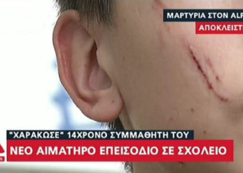 Νέα άγρια επίθεση σε σχολείο: Μαθητής «χαράκωσε» στο πρόσωπο 14χρονο συμμαθητή του (video)