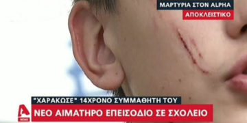 Alldaynews.gr Νέα άγρια επίθεση σε σχολείο: Μαθητής «χαράκωσε» στο πρόσωπο 14χρονο συμμαθητή του (video)
