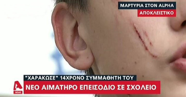 Alldaynews.gr Νέα άγρια επίθεση σε σχολείο: Μαθητής «χαράκωσε» στο πρόσωπο 14χρονο συμμαθητή του (video)