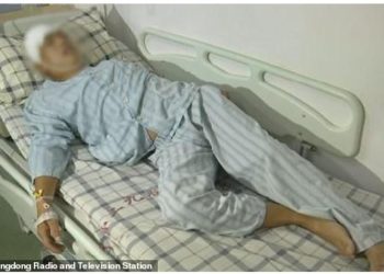 Σκουλήκι ζούσε και έτρωγε τον εγκέφαλο του επί 15 χρόνια – Το έπαθε επειδή έτρωγε πολλά…[photos]