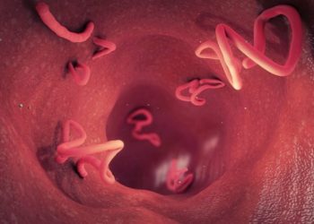 Αναπτύχθηκαν σκουλήκια στον εγκέφαλο 43χρονου αφότου έφαγε χοιρινό που δεν είχε μαγειρευτεί καλά!