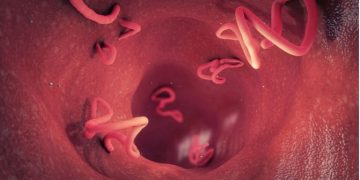 Alldaynews.gr Αναπτύχθηκαν σκουλήκια στον εγκέφαλο 43χρονου αφότου έφαγε χοιρινό που δεν είχε μαγειρευτεί καλά!