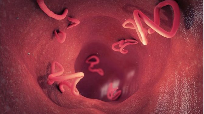 Alldaynews.gr Αναπτύχθηκαν σκουλήκια στον εγκέφαλο 43χρονου αφότου έφαγε χοιρινό που δεν είχε μαγειρευτεί καλά!