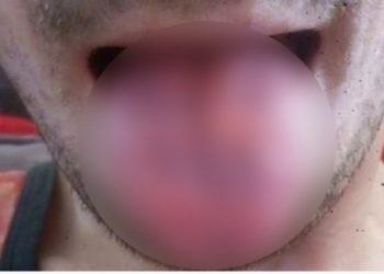 Έπινε δέκα “ενεργειακά ποτά” την ημέρα: Δείτε πώς έγινε![photo]