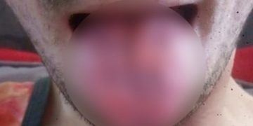 Έπινε δέκα “ενεργειακά ποτά” την ημέρα: Δείτε πώς έγινε![photo]