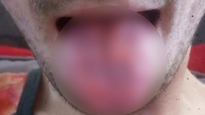 Έπινε δέκα “ενεργειακά ποτά” την ημέρα: Δείτε πώς έγινε![photo]