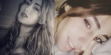 Μοντέλο πέθανε έπειτα από πλαστική