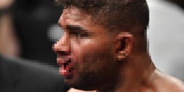 Alldaynews.gr Απίστευτη γροθιά σε αγώνα πυγμαχίας – Του έσκισε όλο το στόμα (ΠΟΛΥ ΣΚΛΗΡΟ VIDEO)